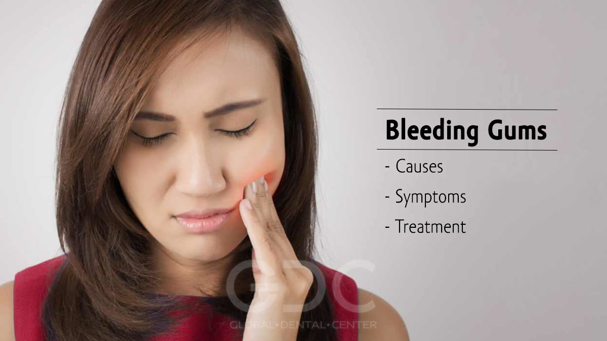 Bleeding Gums: Causes, Symptoms and Treatment