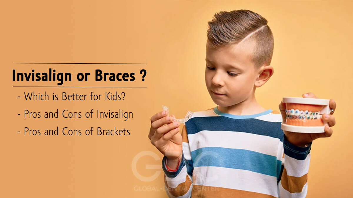 Is Invisalign or Braces Better for Kids?